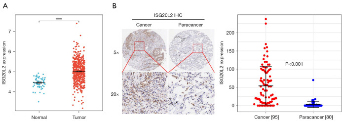 <i>ISG20L2</i> as a driver in the proliferation and invasion of lung adenocarcinoma via <i>NKX2-1</i> regulation.