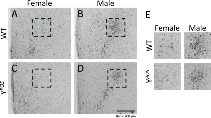 Morphological Sex Reversal in the Sexually Dimorphic Nucleus of the Preoptic Area in the Hypothalamus Delineated by Calbindin D28k-Immunoreactive Cell Clusters in Y <i><sup>POS</sup></i> mice.