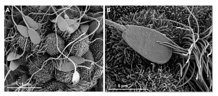 Oviduct epithelium interactions: roles in sperm selection and embryo quality.