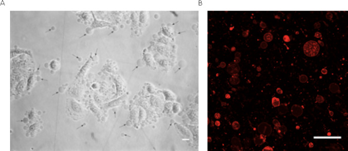 Development of Cell-Derived Plasma Membrane Vesicles as a Nanoparticle Encapsulation and Delivery System.