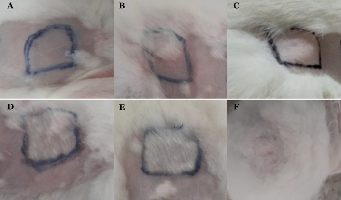 Hybrid function of light fraction patchouli oil in hair care formulations for effective hair and anti-dandruff treatment.