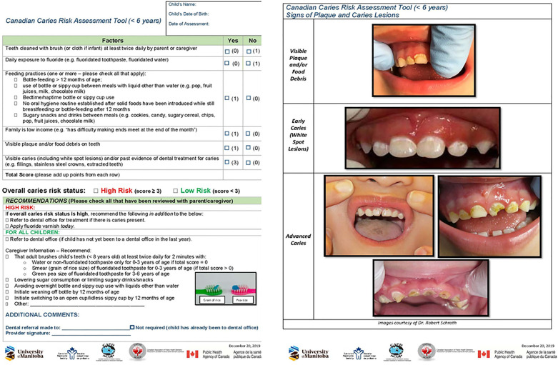 Identifying training needs of healthcare providers to implement caries risk assessment.