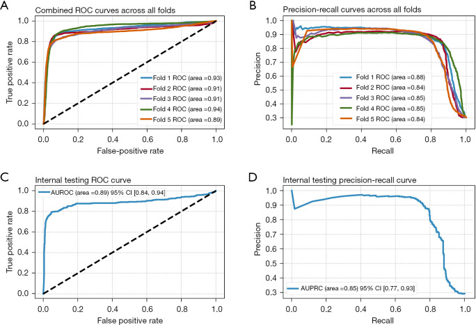 ChronoSynthNet: a dual-task deep learning model development and validation study for predicting real-time norepinephrine dosage and the early detection of hypotension in patients with septic shock.