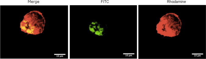 Development of Cell-Derived Plasma Membrane Vesicles as a Nanoparticle Encapsulation and Delivery System.
