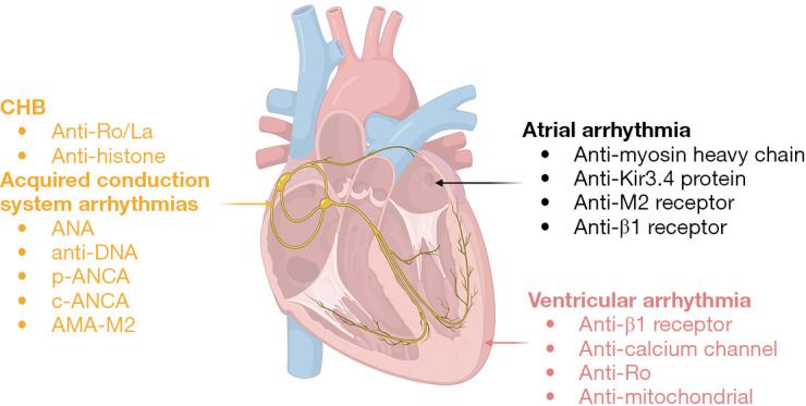 Autoimmune antibodies in arrhythmia: a narrative review of potential therapeutic targets to prevent overtreatment.
