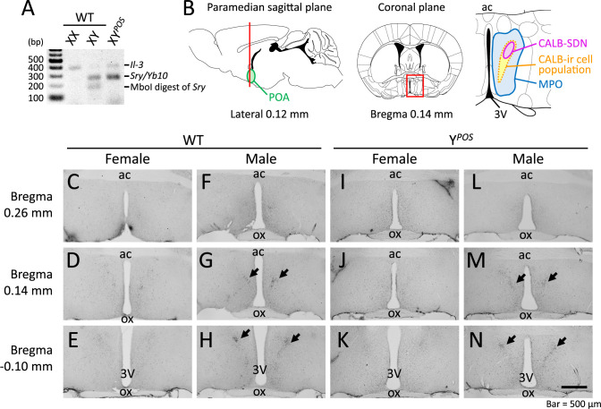 Morphological Sex Reversal in the Sexually Dimorphic Nucleus of the Preoptic Area in the Hypothalamus Delineated by Calbindin D28k-Immunoreactive Cell Clusters in Y <i><sup>POS</sup></i> mice.