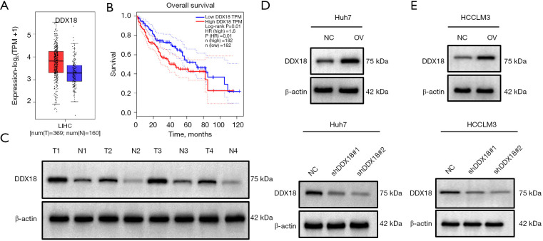 DDX18 promotes growth and metastasis of hepatocellular carcinoma via activating EMT and MAPK signaling.