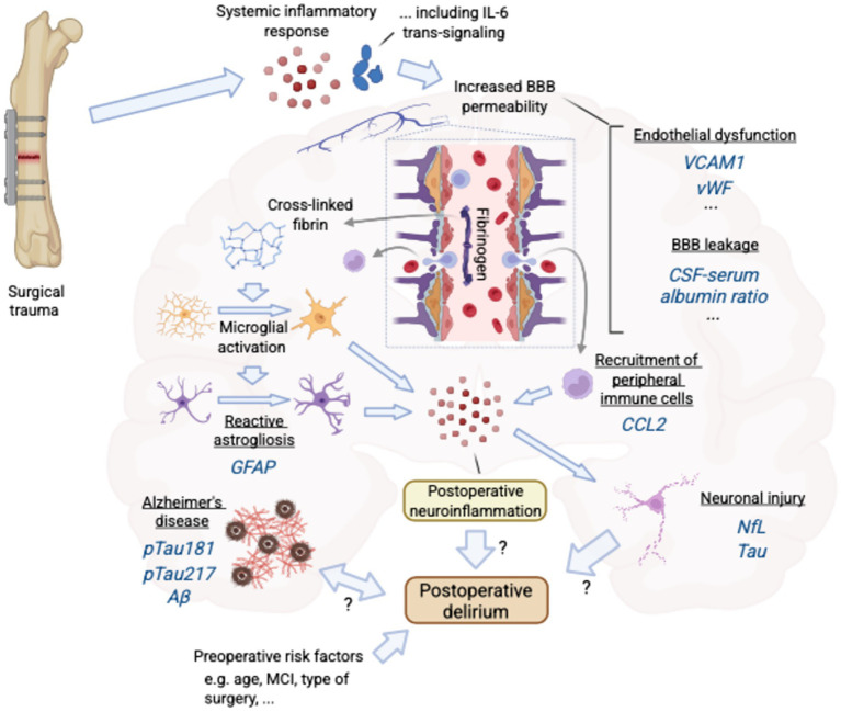 Emerging biomarkers of postoperative delirium at the intersection of neuroinflammation and neurodegeneration.