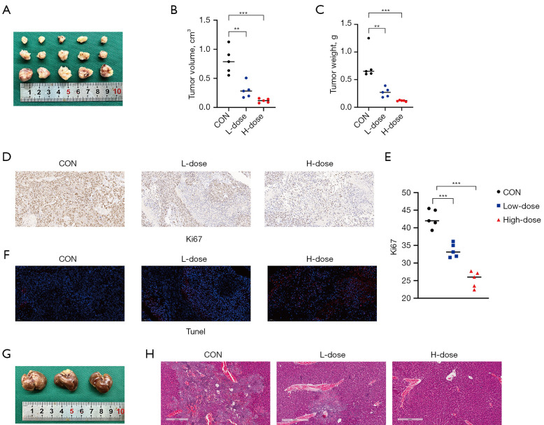 Enhanced antitumor efficacy of sorafenib and everolimus combination in pancreatic neuroendocrine neoplasms through mTOR inhibition.