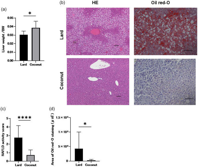The effects of coconut oil intake on metabolic disorders and fatty liver disease in mice.