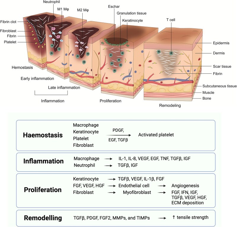 Advancing injectable hydrogels for wound treatment: targeted control of oxidative stress toward personalized regeneration.
