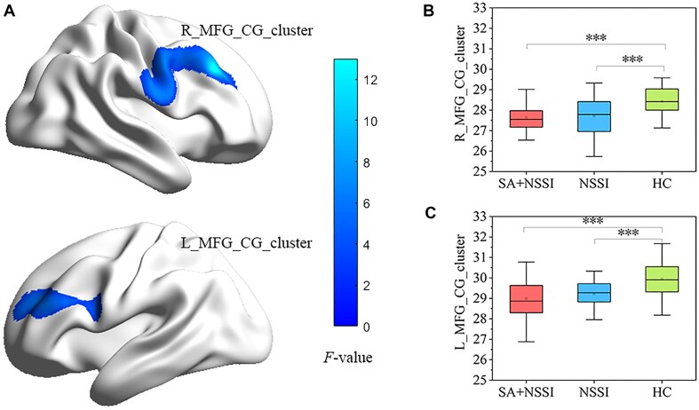 Altered local gyrification index and corresponding functional connectivity in female depressed adolescents with suicide attempts and non-suicidal self-injury.