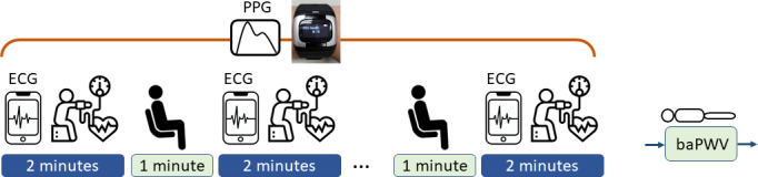 Estimation of Brachial-Ankle Pulse Wave Velocity With Hierarchical Regression Model From Wrist Photoplethysmography and Electrocardiographic Signals: Method Design.