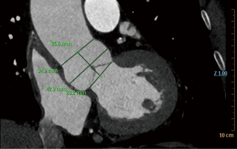 Digital clinical teaching of cardiovascular surgery supported by precision imaging and 3D printing technology: a randomized parallel-controlled trial.