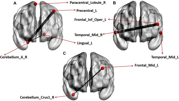 Oxytocin modulation of resting-state functional connectivity network topology in individuals with higher autistic traits.