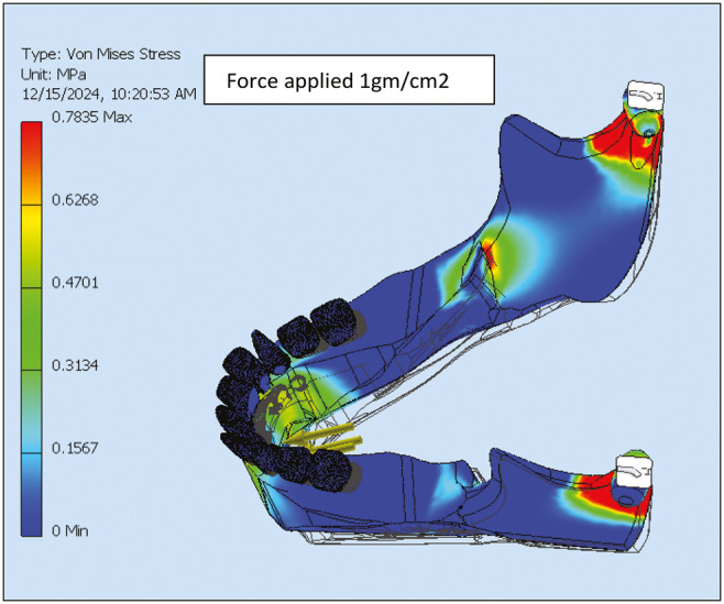 Tongue Behaviors and Their Impact On Mandibular Anterior Structure: A Finite-Element Study.
