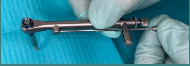 The assessment of untreated surface orthodontic mini-implants' osseointegration through three successive methods.