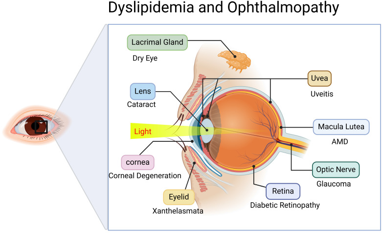 Association between Disorders of Lipid Metabolism and Oculopathy: An Overview.