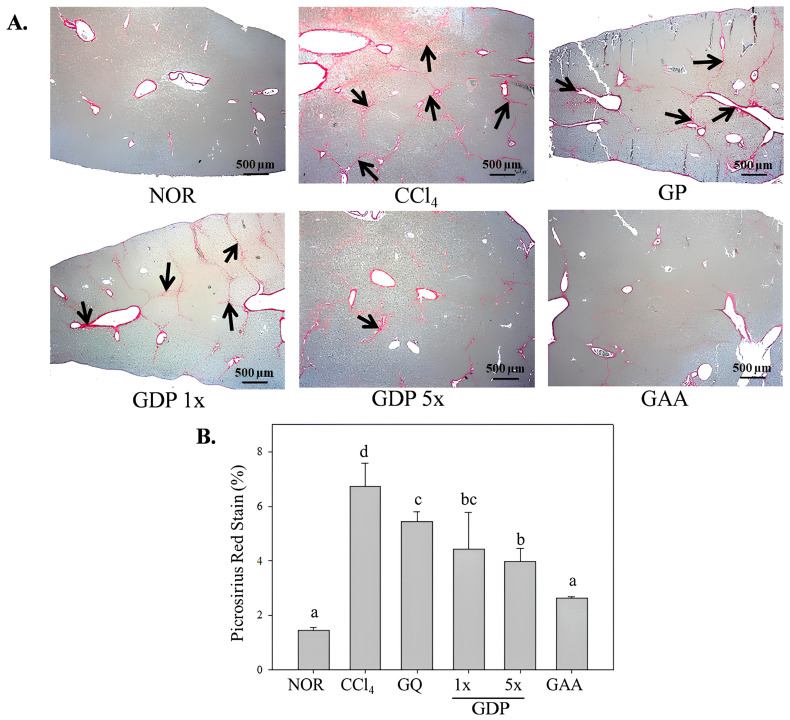 Sublingual Dripping Pill Formulation of <i>Ganoderma amboinense</i> Fruiting Body Extract Attenuates CCl<sub>4</sub>-Induced Liver Fibrosis via Multi-Pathway Regulation.