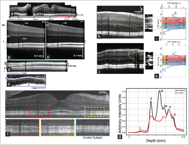 The path to clinical translation for visible light optical coherence tomography in retinal imaging.