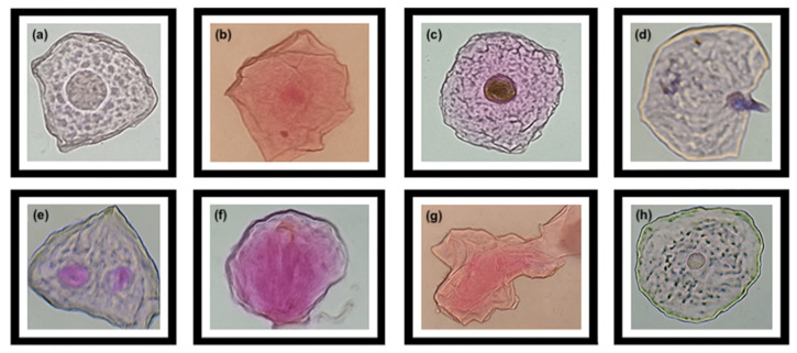 Cytotoxic Effects and Micronuclei Frequency as a Biomarker of Genotoxicity in Farmers from the Municipality of Tehuacán, Puebla, Mexico.