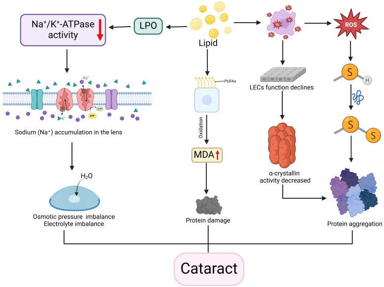Association between Disorders of Lipid Metabolism and Oculopathy: An Overview.