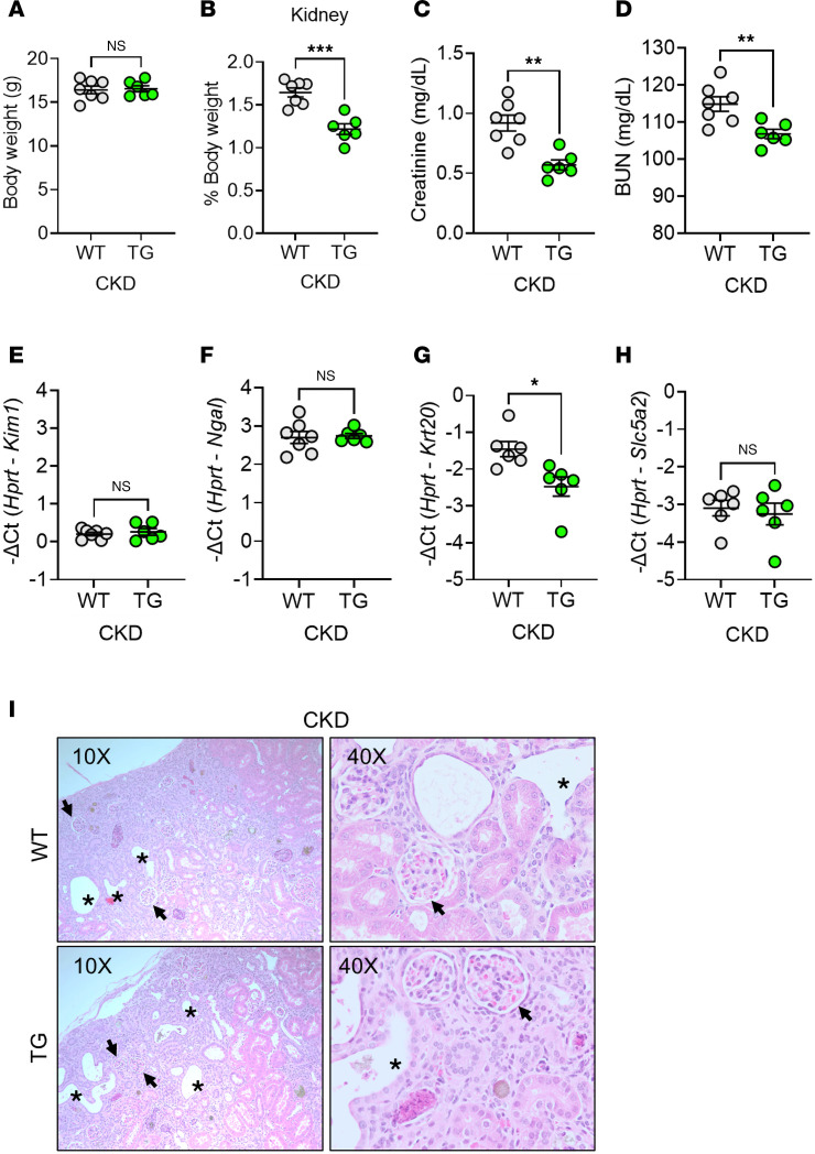 Transgenic augmentation of erythroferrone in mice ameliorates anemia in adenine-induced chronic kidney disease.