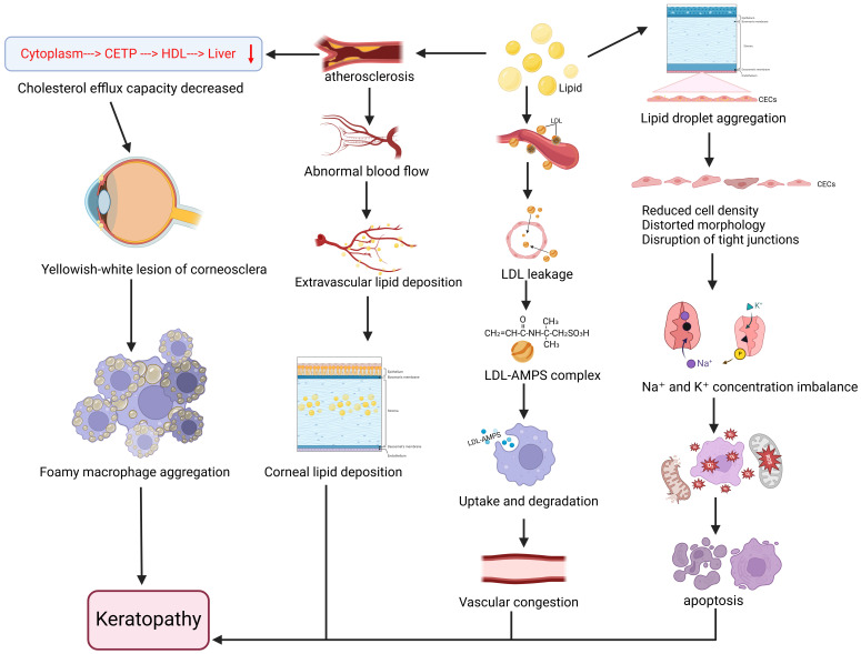 Association between Disorders of Lipid Metabolism and Oculopathy: An Overview.
