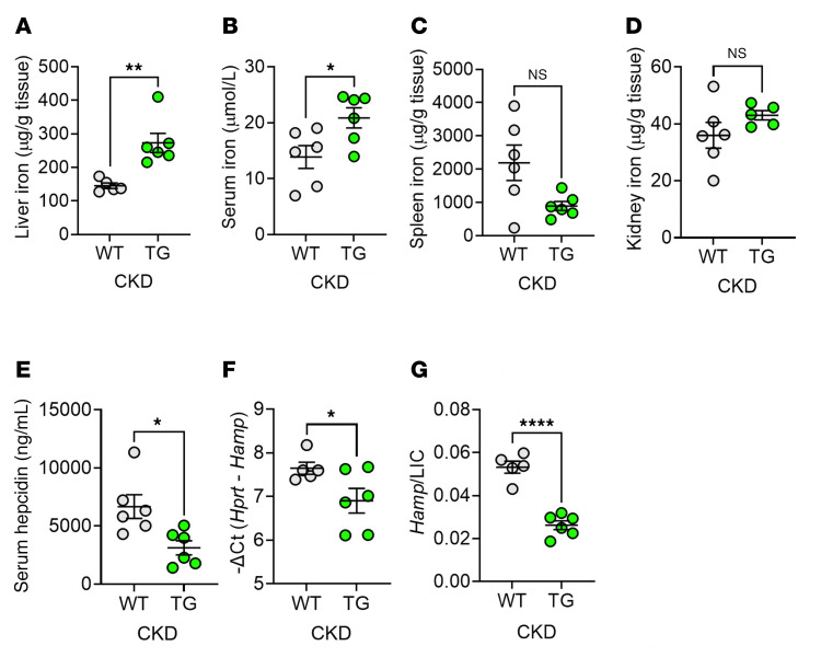 Transgenic augmentation of erythroferrone in mice ameliorates anemia in adenine-induced chronic kidney disease.
