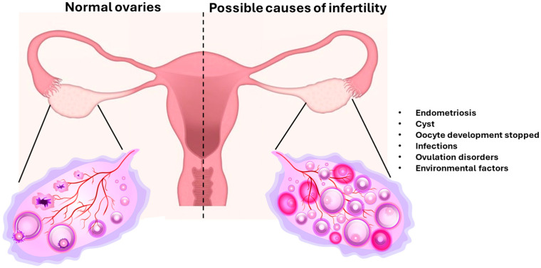 The Dual Role of Nanomaterials in Ovarian Cancer and Female Fertility as Anti- and Prooxidants.