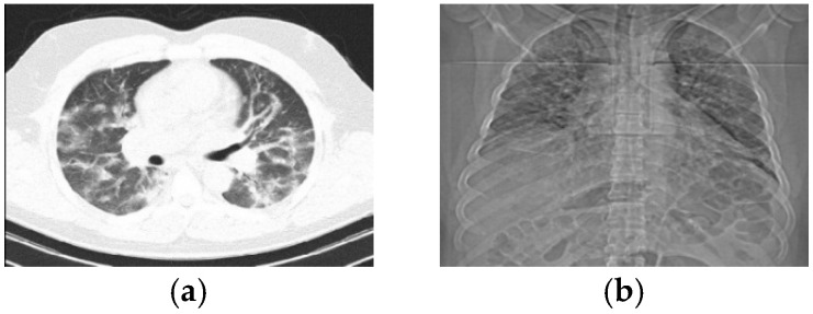 A Flexible Multi-Channel Deep Network Leveraging Texture and Spatial Features for Diagnosing New COVID-19 Variants in Lung CT Scans.
