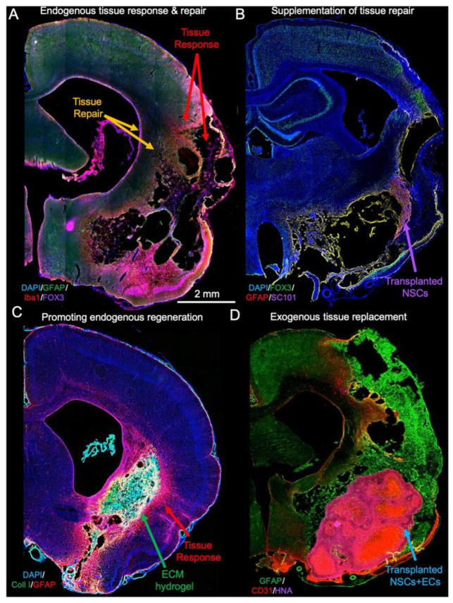 Biomaterials and Tissue Engineering in Neurosurgery: Current Innovations and Future Directions.