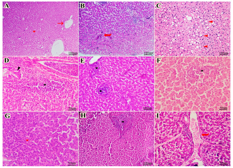 The Effects of Fennel Essential Oil Supplementation on Mitigating the Heat Stress Impacts on Growth Rate, Blood Biochemical Parameters, and Liver Histopathology in Broiler Chickens.