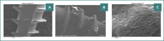 The assessment of untreated surface orthodontic mini-implants' osseointegration through three successive methods.