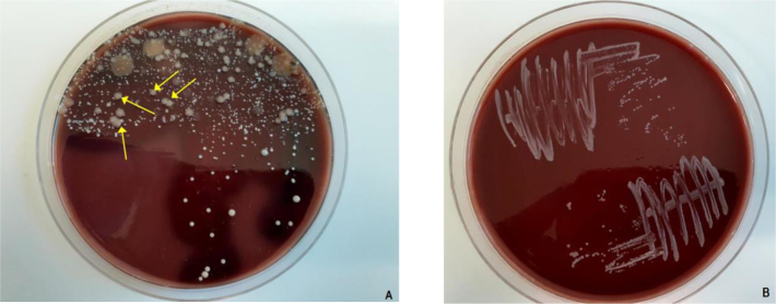 <i>Taylorella equigenitalis</i> infections in Poland - results of current diagnostic investigations.