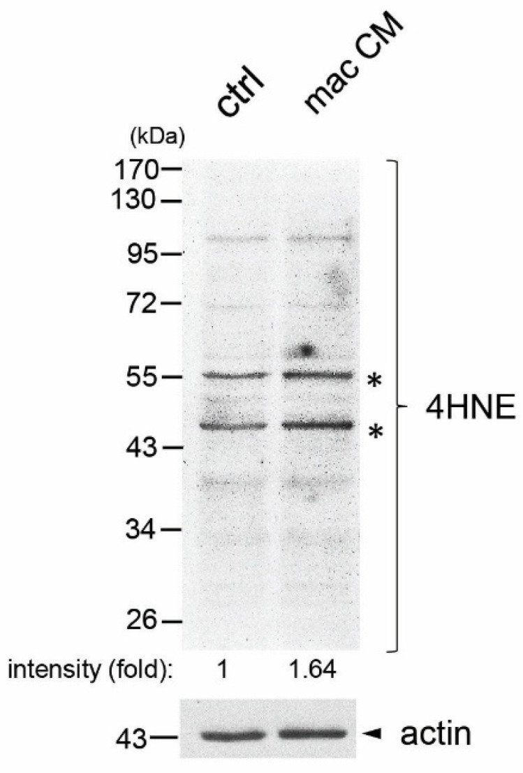 Increased Levels of Oxidative Stress in Human Prostate Intraepithelial Neoplasia and Prostate Cancer: Evidence from 4-Hydroxyneonal Detection and Its Implications.