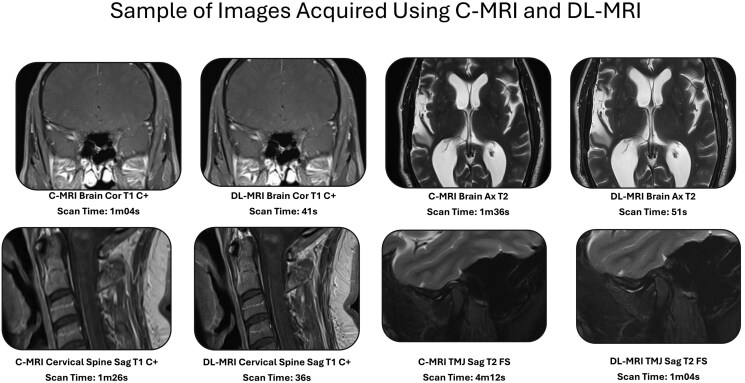 Deep learning MRI halves scan time and preserves image quality across routine neuroradiologic examinations.