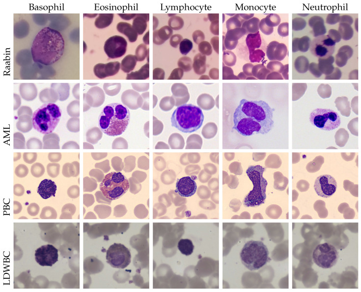 Test-Time Augmentation for Cross-Domain Leukocyte Classification via OOD Filtering and Self-Ensembling.