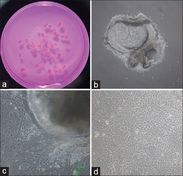 Development of a high-resolution three-dimensional optical coherence tomography for characterization of epithelial cell products for corneal cell therapy.