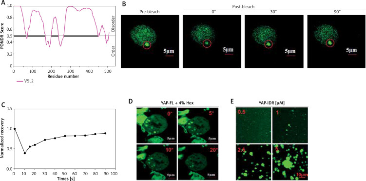 Sentrin/SUMO-specific protease 1 contributes to drug resistance in melanoma by mediating the deSUMOylation of Yes-associated protein.