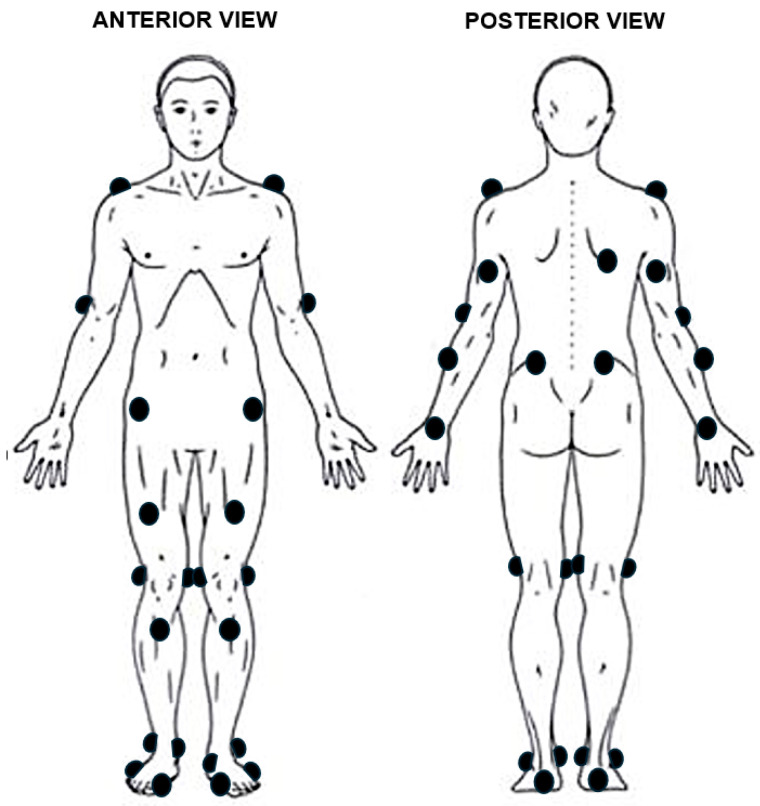 Comparative Biomechanical Strategies of Running Gait Among Healthy and Recently Injured Pediatric and Adult Runners.