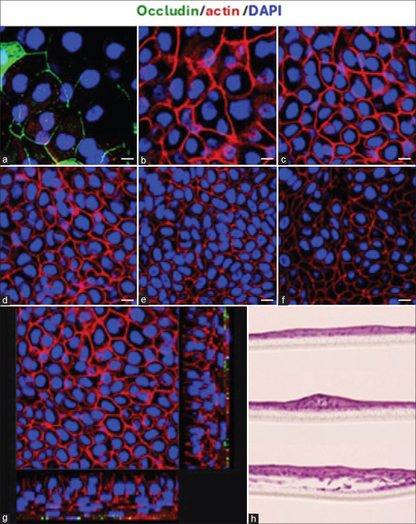 Development of a high-resolution three-dimensional optical coherence tomography for characterization of epithelial cell products for corneal cell therapy.