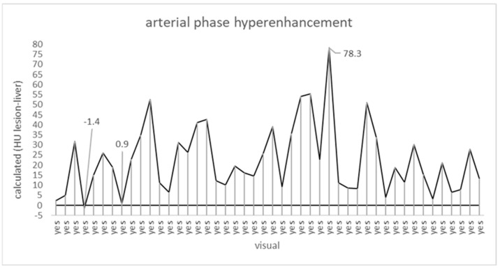 Enhancing LI-RADS Through Semi-Automated Quantification of HCC Lesions.