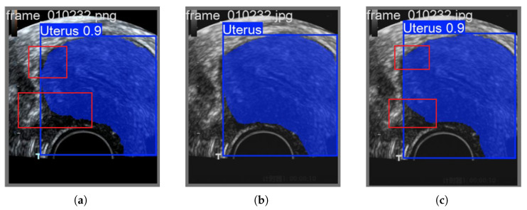 Learning Guided Binary PSO Algorithm for Feature Selection and Reconstruction of Ultrasound Contrast Images in Endometrial Region Detection.