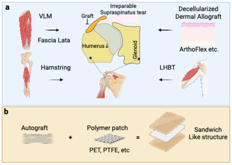 Superior Capsule Reconstruction Graft Selection: The Influence of Biological Properties of Grafts on Healing and Re-Tearing.