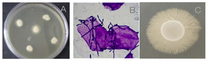 Into the Wild: A Look at <i>Candida albicans</i> Outside the Clinical Setting.