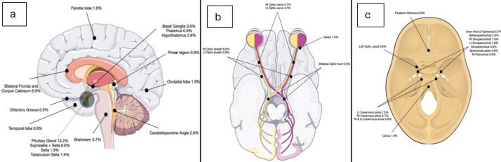 Fractionated Gamma Knife Surgery: Long-Term Results and Patient Outcomes for Intracranial Lesions.