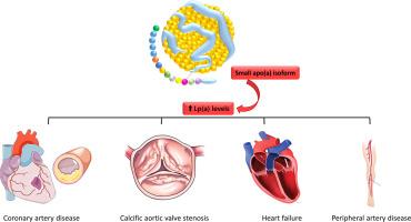 Lipoprotein (a): A new target for pharmacological research and an option for treatment