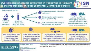 Dysregulated Anaerobic Glycolysis in Podocytes is Relevant to the Progression of Focal Segmental Glomerulosclerosis