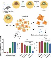 Ultrasound-responsive osteopontin-targeted liposomes Co-delivering curcumin and perfluoro-n-pentane for atherosclerosis therapy